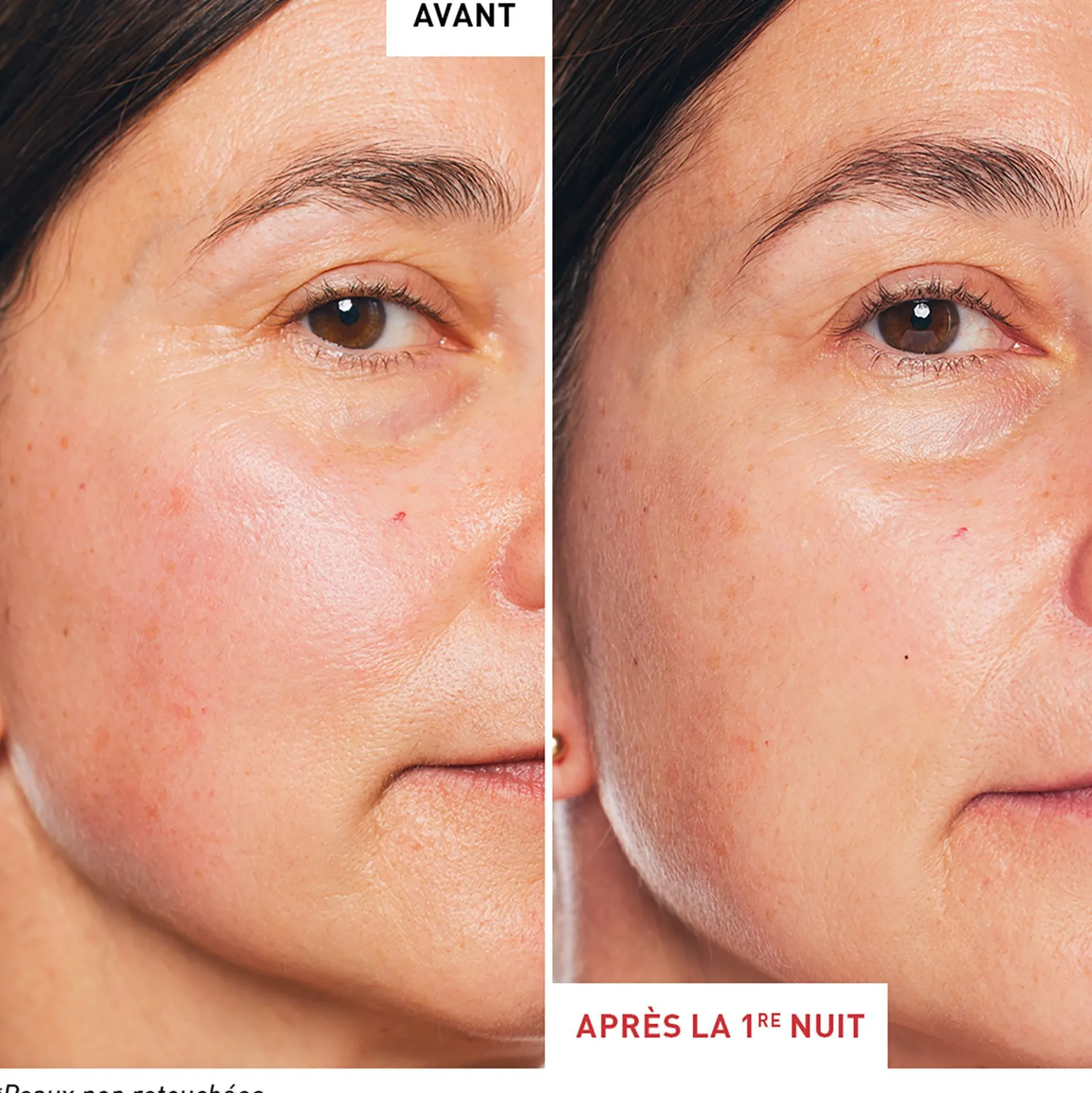 Skin Therapy