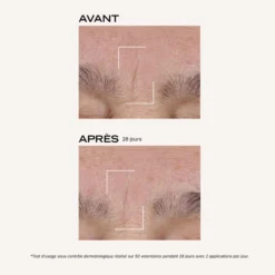 Suprême Absolu