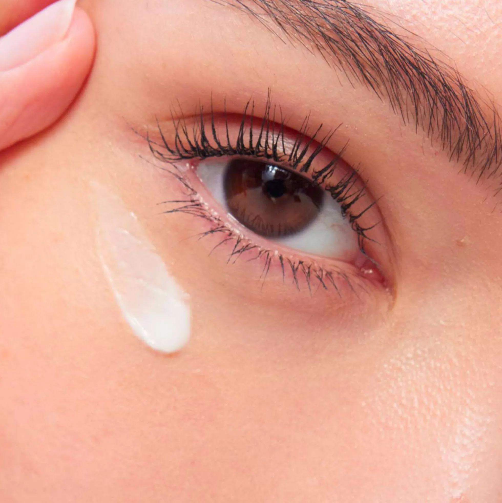 Total Eye Lift